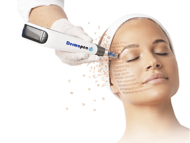 Dermapen Dra Esther Gazituaga Madrid