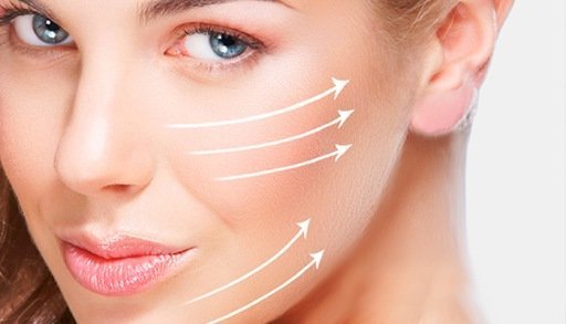 Hilos tensores Madrid, Tratamiento con Hilos, Estética Hilos facial